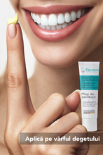 Load image into Gallery viewer, Parodont Gel, tratament parodontoză și gingii, 10 ml