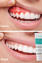 Load image into Gallery viewer, duo: Parodont Gel &amp; pastă de dinți cu chimen negru egiptean