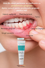 Load image into Gallery viewer, Parodont Gel, tratament parodontoză și gingii, 10 ml